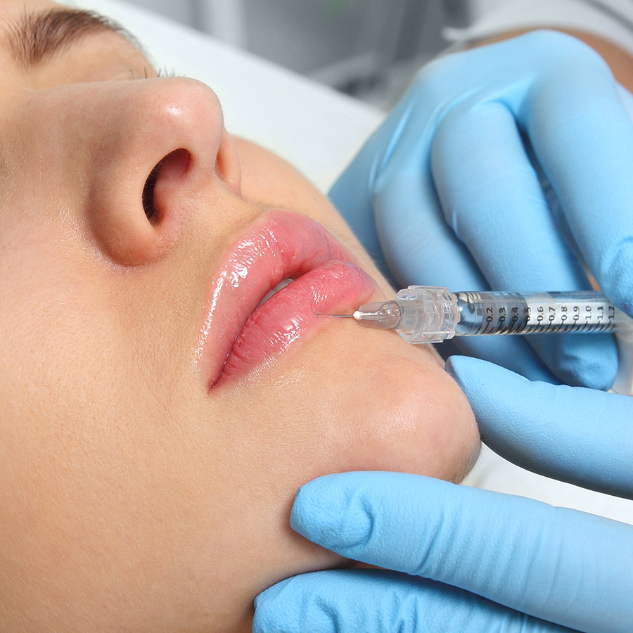 Non-Invasive Lip Filler